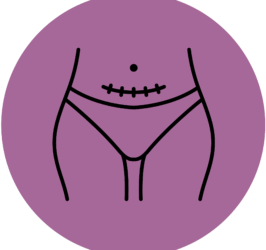 Leczenie blizn